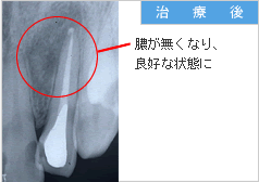 治療後