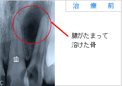 治療前