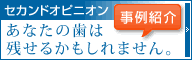 セカンドオピニオン事例サイト